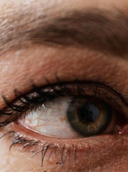 Khô mắt kéo dài tác động tiêu cực đến sức khỏe
