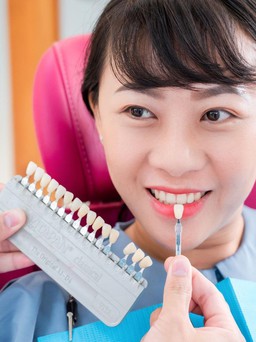 Cẩn trọng khi lựa chọn dán răng sứ không mài: Những điều cần biết
