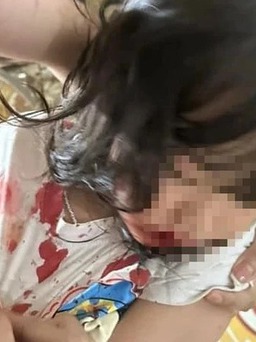 Sức khỏe bé gái ở Hà Giang bị chó tấn công ra sao?