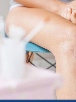 Bị té xe trầy chân nên làm gì để vết thương mau lành và ngừa sẹo xấu?