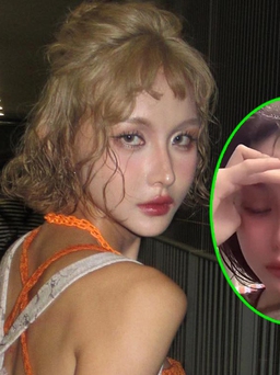 Người mẫu Lâm Minh ôm con livestream khóc lóc trong tình trạng chảy máu miệng