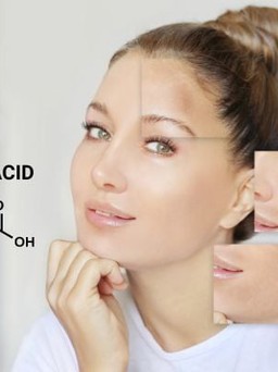 Tranexamic Acid là gì? Tác dụng với làn da và top 3 sản phẩm hiệu quả