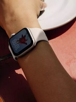 Apple Watch gây bỏng cổ tay người dùng, Apple im lặng suốt 6 tháng