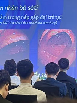 Chuyên gia lưu ý nguy cơ gây ung thư bị bỏ sót trong nội soi tiêu hóa