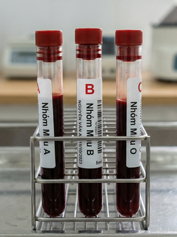 Người nhóm máu nào cần cảnh giác với bệnh tiểu đường hơn?