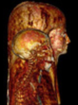 Xác ướp Ai Cập lộ diện qua máy quét CT