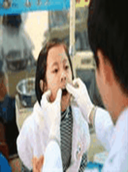 90% người Việt Nam gặp vấn đề răng miệng