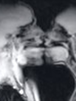Chụp MRI lúc 'yêu'