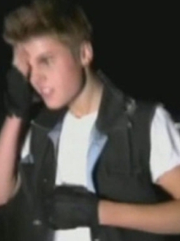Justin Bieber 'khoe' thương tích vụ té cầu thang