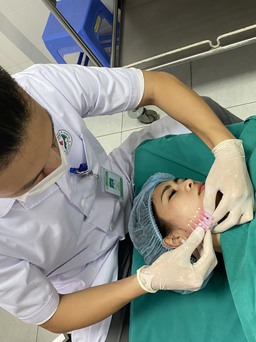 Căng chỉ collagen và những điều cần biết