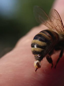 Làm dịu vết ong chích bằng những cách đơn giản
