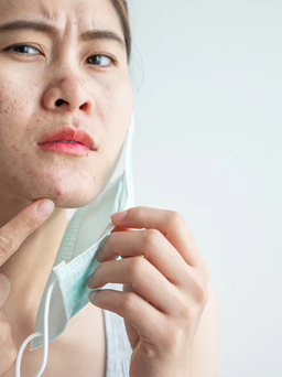 Chăm sóc da mặt khi đeo khẩu trang cả ngày
