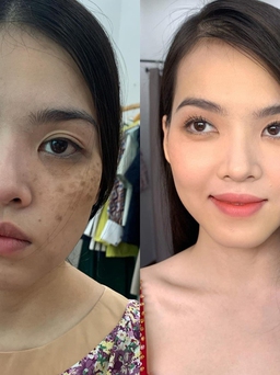 Bí mật đằng sau một làn da không tuổi