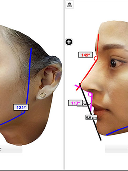 Mách bạn cách chọn lựa dáng mũi phù hợp với gương mặt
