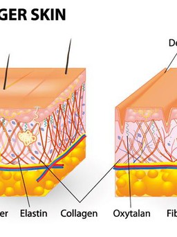 Bổ sung collagen cho làn da căng mịn, trắng hồng