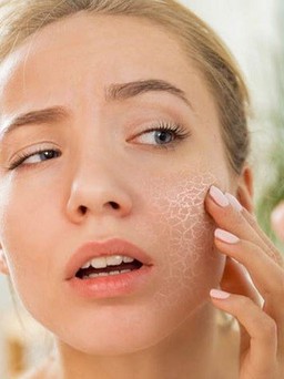 5 nguyên tắc chăm sóc da vào thời điểm ‘giao mùa’ chắc chắn nàng chưa biết