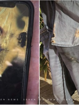 Người đàn ông kiện Apple vì iPhone X phát nổ trong túi quần