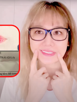 Hari Won suy sụp vì bị liệt mặt trái