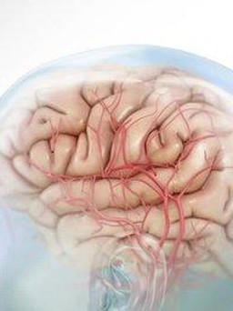 5 dấu hiệu cho thấy bạn đang có một cơn đột quỵ não