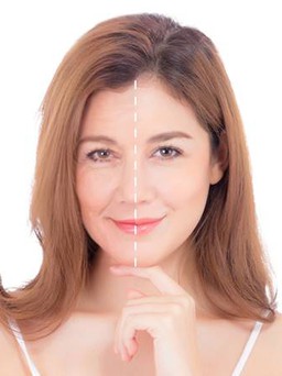 Trẻ hóa da đa tầng - giải pháp ngăn ngừa lão hóa da hiệu quả