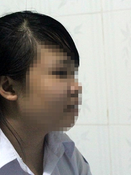 2 nữ sinh bị tạt axít ở Sài Gòn: Kẻ thủ ác ra tay trong 30 giây