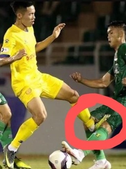 Trọng tài bỏ qua pha bóng thô bạo hơn vụ Hoàng Thịnh làm gãy chân Hùng Dũng