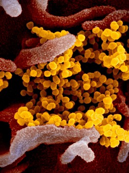 Giới khoa học nói gì về các giả thuyết nguồn gốc virus gây bệnh Covid-19?