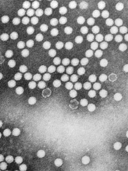 Mỹ ghi nhận ca bệnh bại liệt đầu tiên trong gần một thập niên