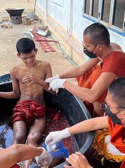 Hàng chục sư sãi tại một ngôi chùa ở Campuchia mắc bệnh lạ