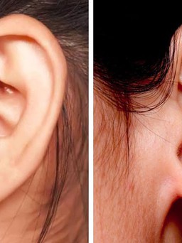 6 lợi ích bất ngờ của mát xa tai có thể bạn chưa biết