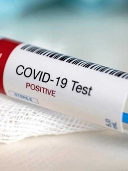 Phát hiện một người nhiễm Covid-19 nhẹ vẫn dương tính suốt 221 ngày