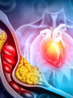 Phát hiện mới: 1 trái này mỗi ngày giúp loại bỏ cholesterol xấu!