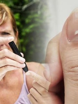 Nhìn móng tay có thể phát hiện sớm bệnh tiểu đường