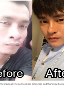 Chàng trai Thái Lan phẫu thuật 30 lần để nhìn giống trai Hàn Quốc