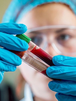 Xét nghiệm máu đơn giản có thể phát hiện 7 loại ung thư nguy hiểm
