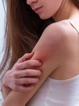 5 dấu hiệu của da quá nhạy cảm và cách khắc phục