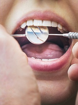 Chê đắt đỏ, người phụ nữ tự chăm sóc răng, tự nhổ răng