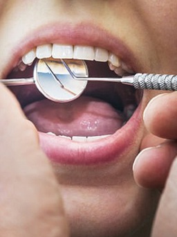 Dùng thuốc tê vứt bỏ để nhổ 13 chiếc răng cho bệnh nhân