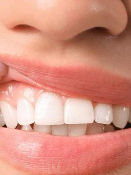 4 bệnh có thể xuất hiện dấu hiệu ở răng