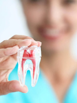 Điều gì sẽ xảy ra với răng khi bạn lấy tủy ?