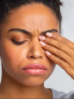 Vì sao lẹo mắt lại tái phát dù chăm sóc mắt tốt?