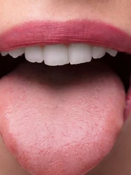Điều gì đang xảy ra với cơ thể khi lưỡi bỗng dưng tái nhợt?