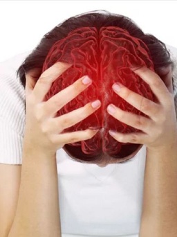 Làm sao phân biệt cơn đau nửa đầu và phình mạch não?