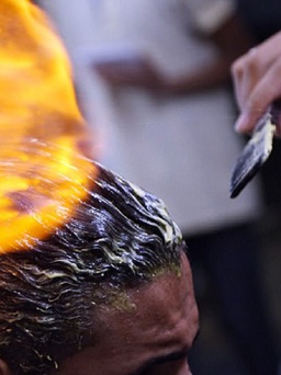 Dùng lửa để tạo kiểu tóc, nam thanh niên nhập viện vì bỏng nặng