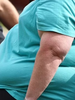 Giảm cân được 167 kg, người phụ nữ phải cắt bỏ 21 kg da thừa