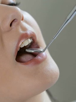 Chăm sóc răng miệng tốt có thể ngừa ung thư