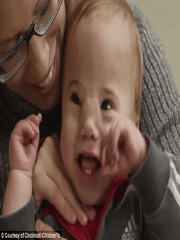 Cậu bé 'Pinocchio' đã được phẫu thuật và cười tươi