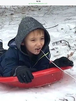 Cậu bé 6 tuổi dùng xe trượt tuyết để... nhổ răng