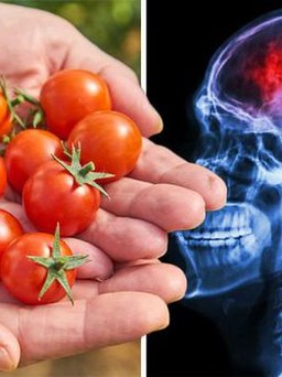 Khoa học: Loại quả thần kỳ giúp giảm đến hơn một nửa số ca đột quỵ