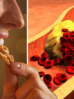 Đây là loại hạt tốt nhất để giảm cholesterol 'xấu' một cách tự nhiên